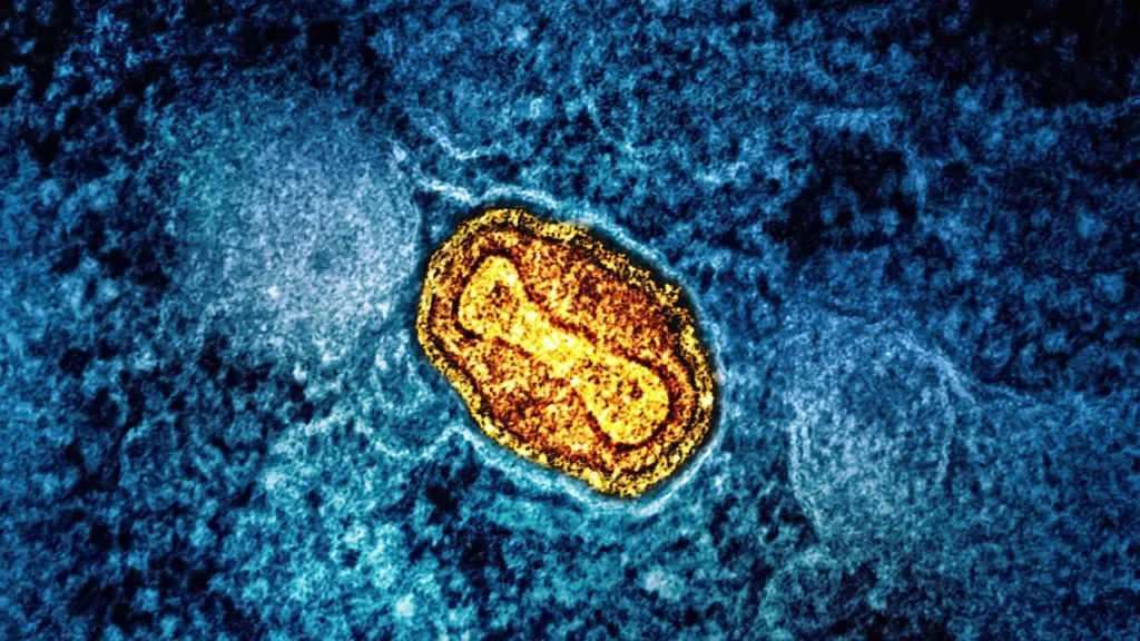 An mpox virus particle (yellow and red)